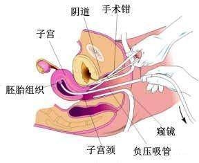 人流综合反应
