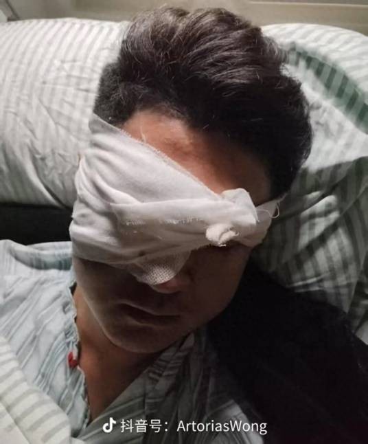 1·28淮南男子被烟花炸伤事件