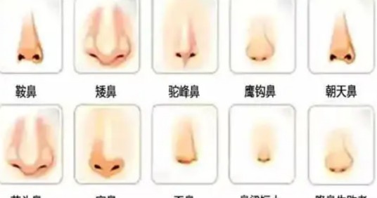 鼻型