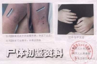 黄静裸死案回顾:历经五次尸检,男友嫌疑重大,最终怎样?