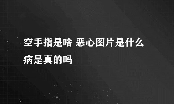 空手指是啥 恶心图片是什么病是真的吗