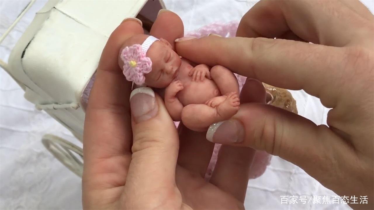 生命奇迹！“世界最小婴儿”出生仅25厘米，如今18岁的她怎样了？
