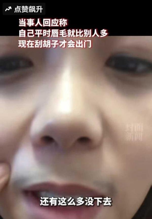女子回应阳后长出浓密胡须，称自己本就浓密，请大家不要恐慌。