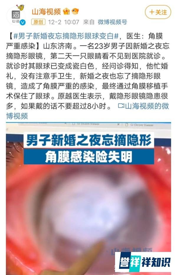 眼见为实 | 男子新婚夜忘摘隐形眼镜，眼球竟然变白了！