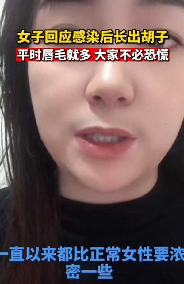 女子回应阳后长出浓密胡须，称自己本就浓密，请大家不要恐慌。