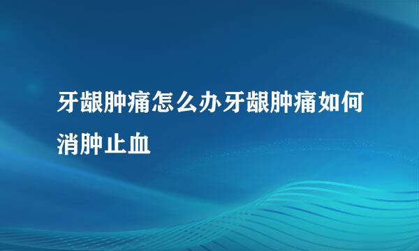 牙龈肿痛怎么办牙龈肿痛如何消肿止血