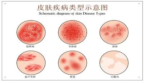 手臂上长红色的小点点是什么原因