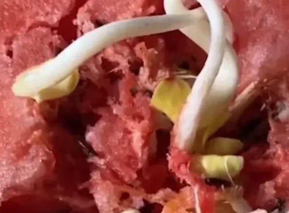 种瓜得豆？女子切开西瓜发现黄豆芽，专家作何解释？
