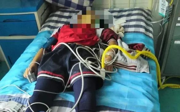 四川10岁女孩被体罚后昏迷去世,老师会负全部责任吗?