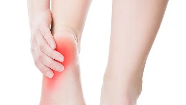 类风湿病的治疗方法是什么？