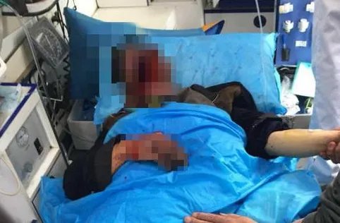 村民寻药遭黑熊袭击有人受伤吗?