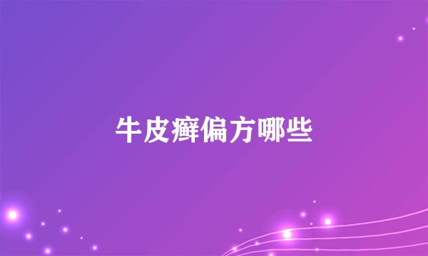 牛皮癣偏方哪些