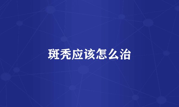 斑秃应该怎么治