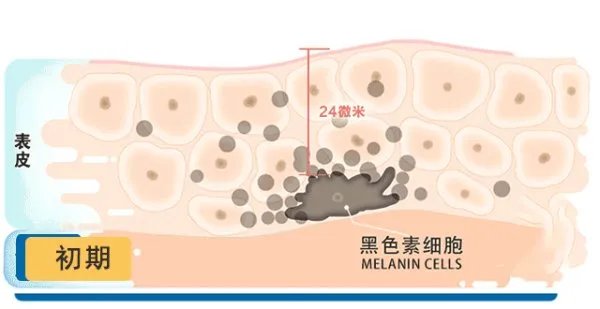 斯朵夫激活祛斑霜有什么作用 管用吗