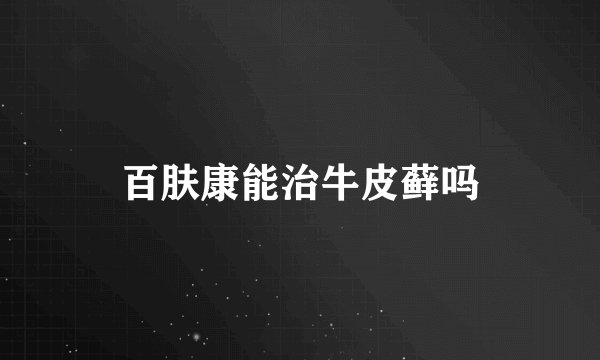 百肤康能治牛皮藓吗