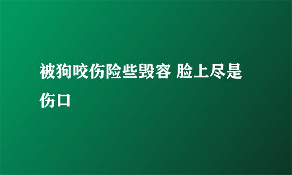 被狗咬伤险些毁容 脸上尽是伤口