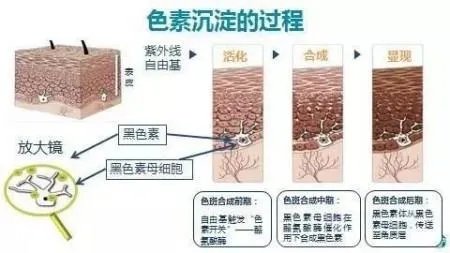 请问十倍金祛斑产品到底怎么样呢？