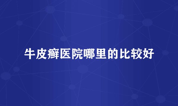 牛皮癣医院哪里的比较好
