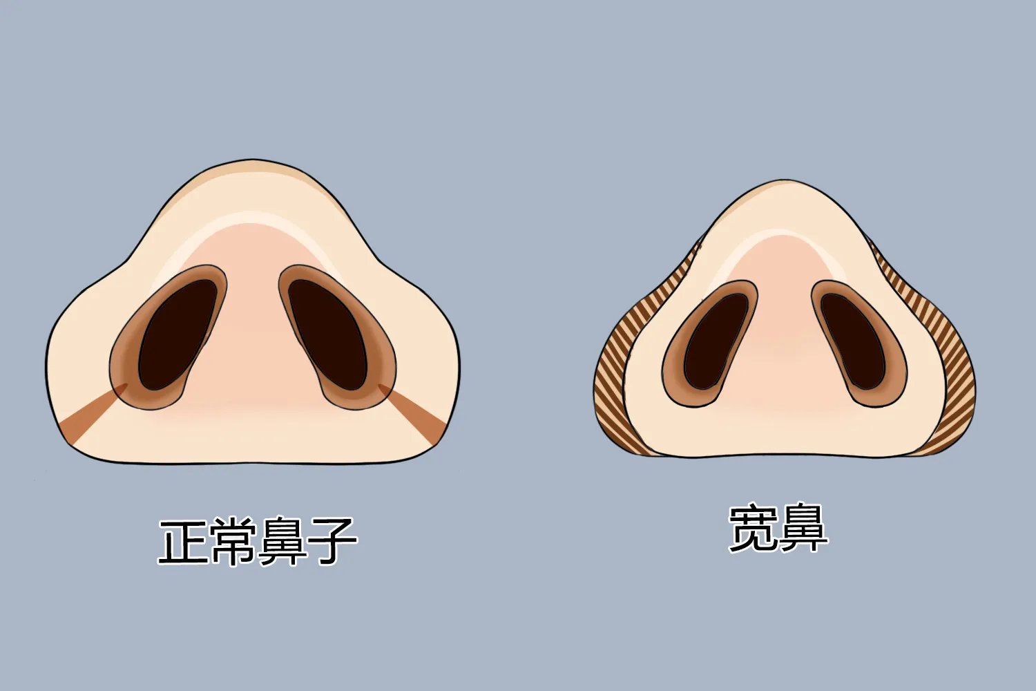 鼻子形状及图片大全