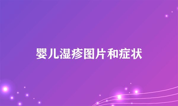 婴儿湿疹图片和症状