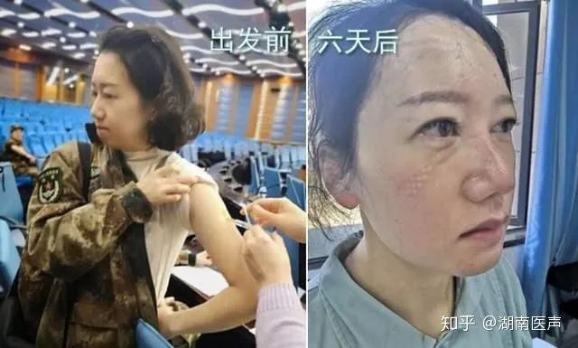 为什么美国那么多人确诊了，但是特朗普周围一直没事？
