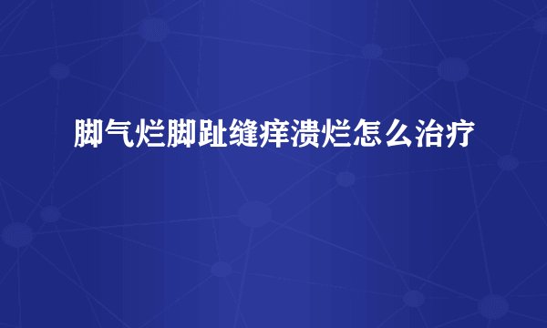 脚气烂脚趾缝痒溃烂怎么治疗
