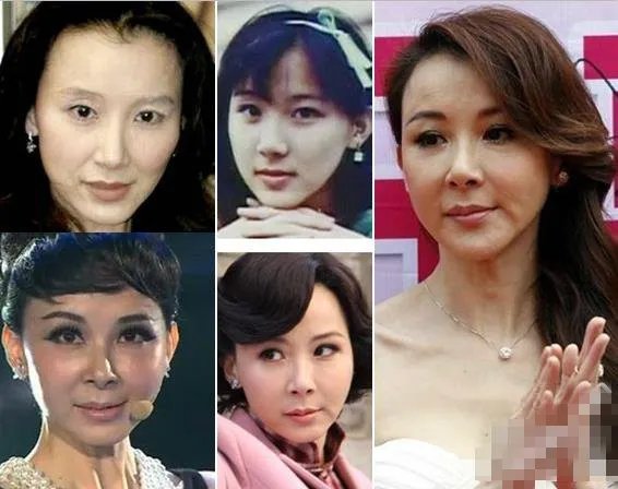细扒萧蔷整容前后照片对比 判若两人清纯气质不再