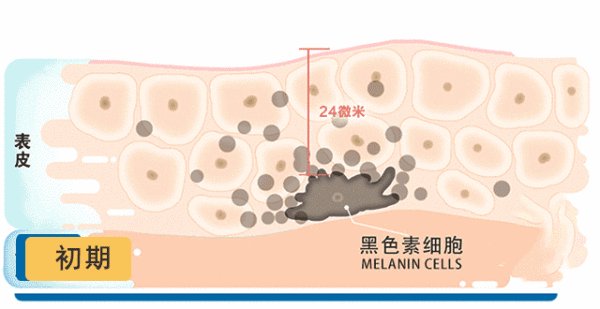 谁用过吉米和摩氧的祛斑产品，这些都是真的吗？那个更好一些