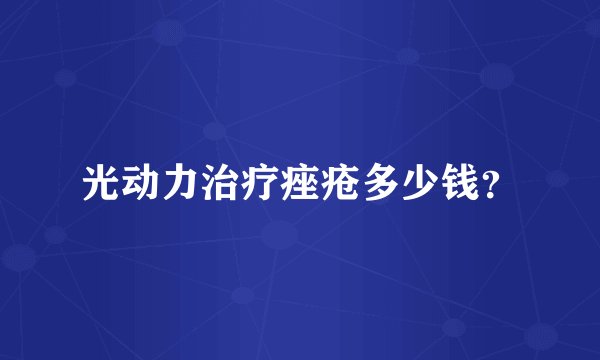 光动力治疗痤疮多少钱？