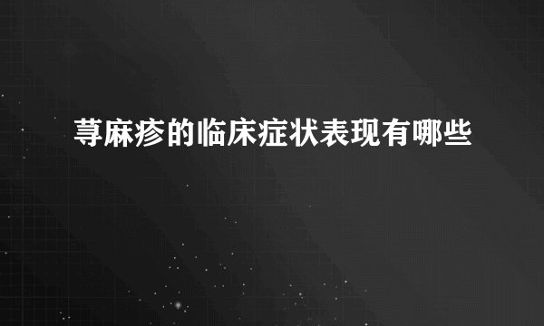 荨麻疹的临床症状表现有哪些