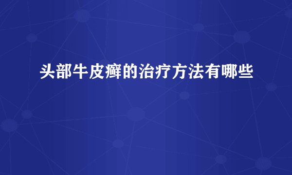 头部牛皮癣的治疗方法有哪些